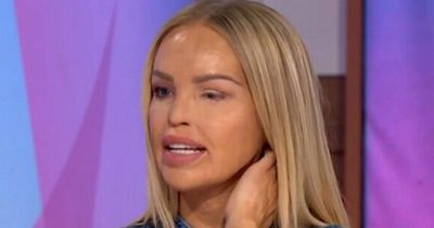 Loose Women's Katie Piper back on show after 'painful' health ordeal and emergency surgery