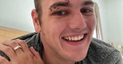 Good samaritan who saved drowning dog hospitalised after animal bit his face