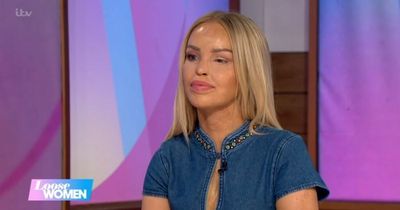 ITV Loose Women's Katie Piper's humble response as she shares details on eye surgery after hole in eye left her in 'intolerable pain'