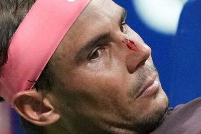 Rafael Nadal left bloodied at US Open after blow to the face from his OWN RACKET during Fabio Fognini win