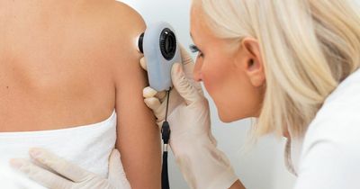 Skin cancer breakthrough as scientists discover new treatments