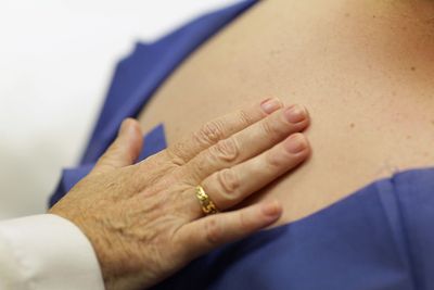 New Treatments For The Most Severe Form Of Skin Cancer Could Be Made Possible