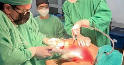 Doctors remove 100lb tumour from woman barely able to breathe, speak or lie down