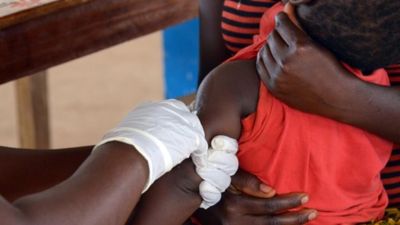 Measles outbreak in Zimbabwe kills 700 children despite available vaccine