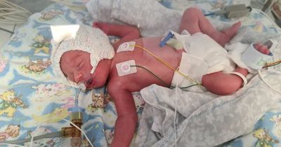 Family's world 'put on hold' as newborn son rushed to ICU