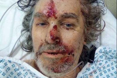 Bike courier: Horrific crash in Walthamstow left me in bed for months