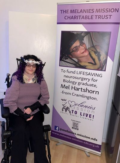 Woman who is only person in world with full-time metal halo ‘needs £70,000 operation to survive’