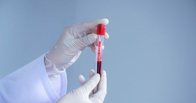 New blood test claims to detect cancer cells before symptoms begin