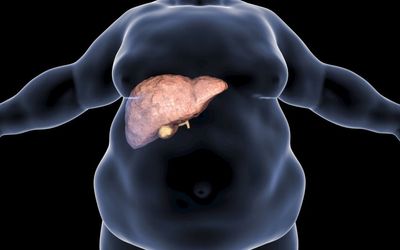 Fatty liver linked with heart failure within a decade, but it’s easily fixed