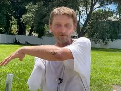 Man miraculously survives three days in woods after fleeing alligator that ripped off his arm