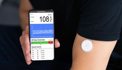 Ask the Doctors: CGM a useful tool for tracking blood glucose in real time