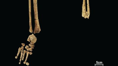 Earliest-known surgical limb amputation found in 31,000-year-old skeleton from Borneo cave