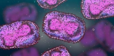 Monkeypox may cause neurological damage, including inflammation of the brain – new study