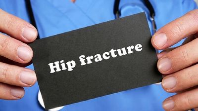 Research: Hip fractures will double worldwide by 2050