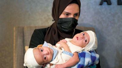 Iraqi Siamese Twins Omar and Ali Arrive in Riyadh