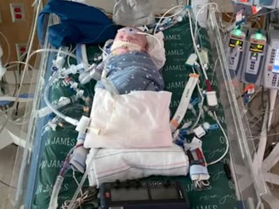 World-first ‘living tissue’ partial heart transplant saves newborn baby