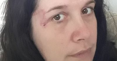 Mum's 'hairbrush scratch' turned out to be skin cancer