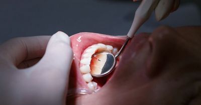 Poor dental health may increase risk of dementia, claims study