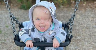 West Lothian tot lost eye to rare cancer after being 'fobbed off' by doctors