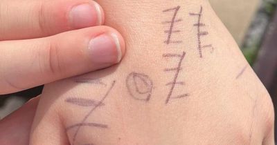 Dad's horror as son returns from school with marks on hand recording two days of bullying