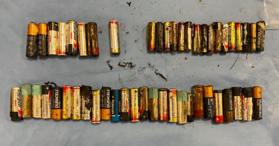 Woman has 50 batteries removed from stomach and colon at Dublin hospital
