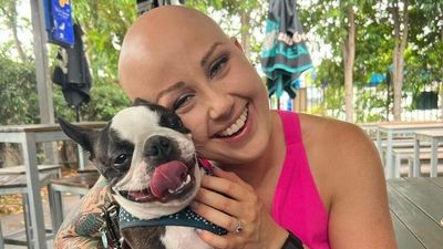 Alopecia areata led to Katie moving cities, but Instagram helps her talk about hair loss