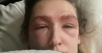 Mum hospitalised after getting eyebrows tinted at Superdrug