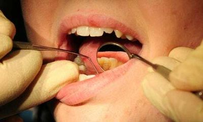 Londoners least likely to have seen NHS dentist in past two years in ‘postcode lottery’