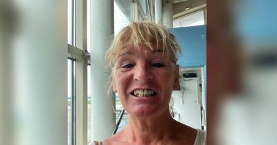 Woman who says she looks like 'Nanny McPhee' flies out for 'Turkey teeth' after '£19,000 treatment quote'