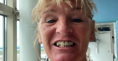 Woman jets to Turkey after UK dentist quotes her £19,000 for treatment