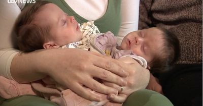 Parents' relief and joy as conjoined twins separated after Covid delayed risky surgery