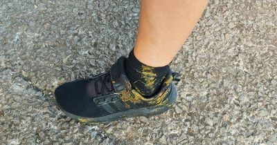 Young rugby player left covered in dog poo at training as concerned parent wants dogs banned from pitches