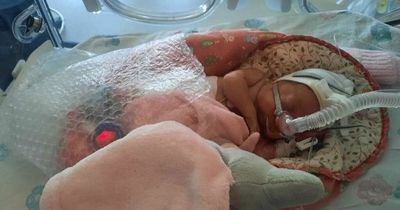 Dad who paid £900 in petrol to see his premature baby at Glasgow hospital calls for paid leave