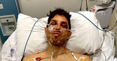 The fearless mountain biker back racing just a year after breaking nearly everything in horror Snowdonia crash