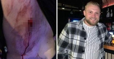 Belgian pub manager 'stabbed with broken glass' after confrontation with Shamrock Rovers fans