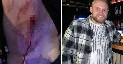 Pub boss stabbed after confronting group of Shamrock Rovers fans blasts them as 'real hooligans'