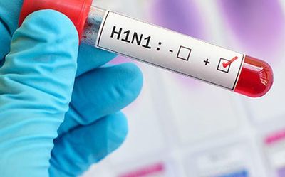 Namakkal woman dies of H1N1 influenza