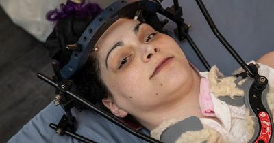 Woman with 'unbearable' dislocated skull must raise £46,000 in two weeks for life-saving surgery