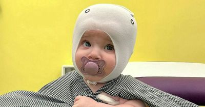 Parents raising £3,000 for helmet for baby to cure condition NHS won't fix