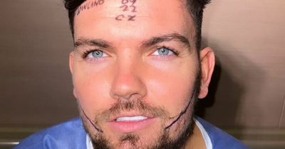 Love Island's Sam Gowland unrecognisable with swollen face after beard transplant