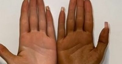 Woman shares unusual hack for removing fake tan using toothpaste and a brush