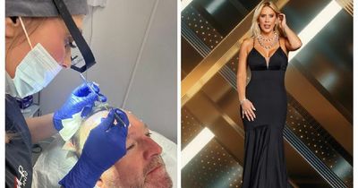 ITV Real Housewives star treats partner to hair transplant for his 52nd birthday as he hopes to 'break stigma' of male hair loss