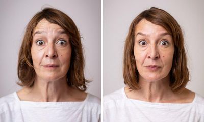 Why has Britain fallen in love with Botox? There is only one way to find out ...