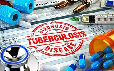 India must fine-tune its strategy to eliminate Tuberculosis