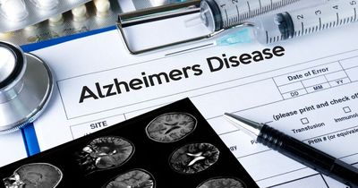 World's first EVER drug shown to work against Alzheimer's developed by scientists
