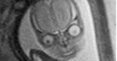 'Cursed' image of unborn baby taken during MRI scan left Reddit users in stitches