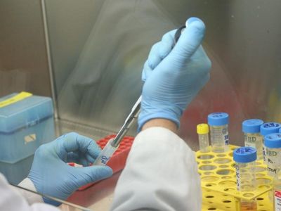 Weed killer detected in Australian urine