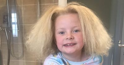 Schoolgirl with same rare condition as Einstein embraces frizzy locks