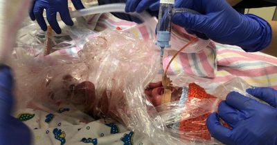 'Miracle' baby born weighing a tiny 1lb 2oz and kept alive in a sandwich bag now healthy two-year-old