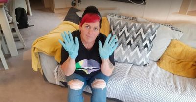 Mum says power supply at home 'so dangerous' she 'wears rubber gloves to shower'